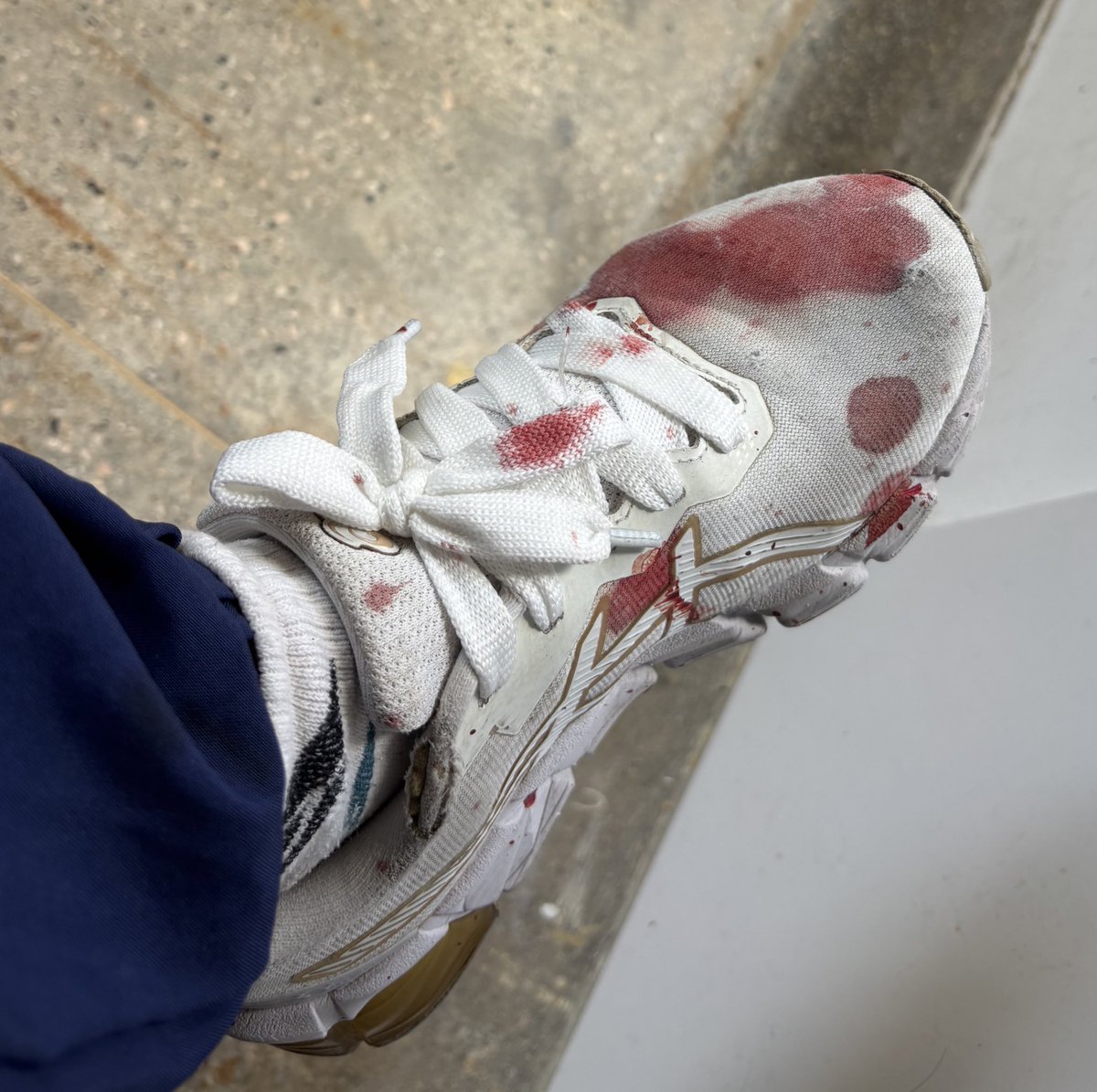 alexiskarev's tweet image. vim de tênis branco pq achei que ia só evoluir os pacientes da clínica médica, do nada o samu traz uma gestante em tp ativo