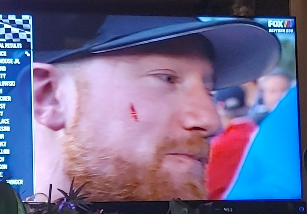 For a second there I thought <a href="/TylerReddick/">Tyler Reddick</a>  got punched in the face 
#YAHDOG
#YPR
#TLSR