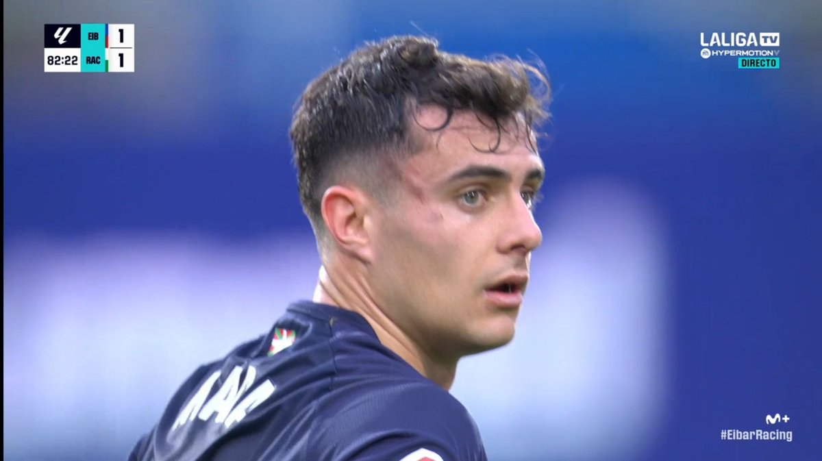 El técnico del Racing Club de Santander, José Alberto López, habla de “partido limpio y noble” y que no era expulsión. Curiosa manera de entender la intensidad cuando las imágenes dicen otra cosa. 🤔⚽ <a href="/JoseAlbertoLpez/">Jose Alberto López</a>