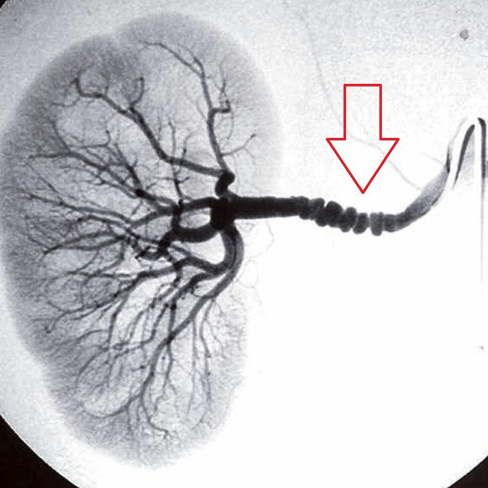 IhabFathiSulima's tweet photo. What is the diagnosis? https://t.co/1hIeD5q7p7