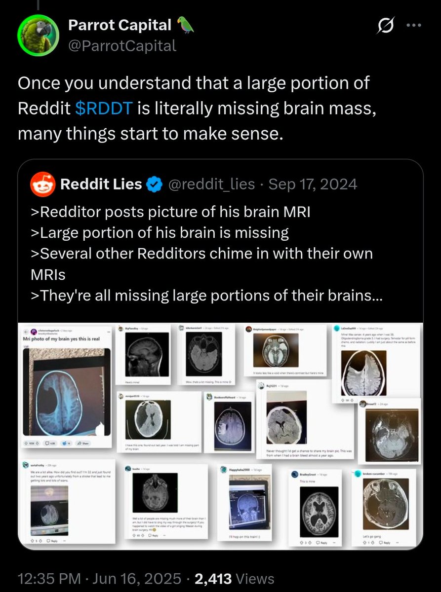 ParrotCapital's tweet image. Sir, it could just be a Reddit user.
Many such cases.
I've confirmed it.