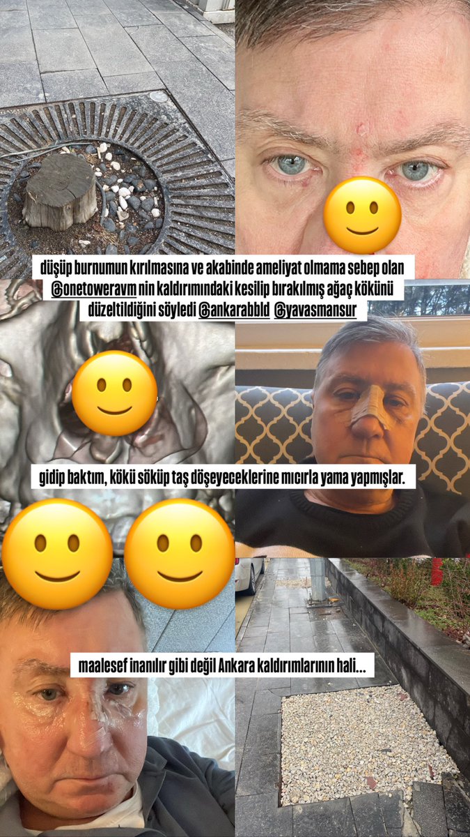 sermet severoz tweet media