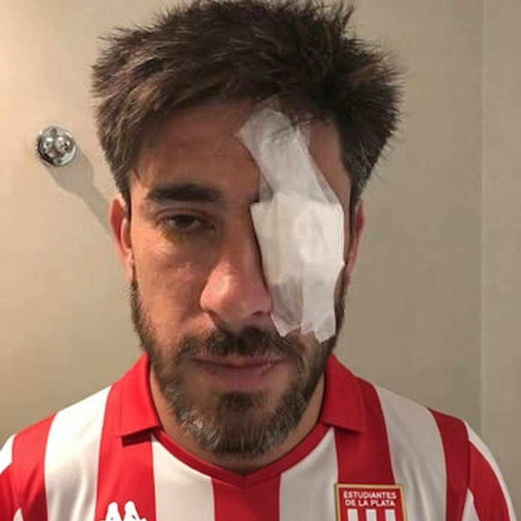 Piedrazo al micro de Estudiantes en su llegada al Estadio de Gimnasia.
Ya empiezan a aparecer las primeras imágenes: