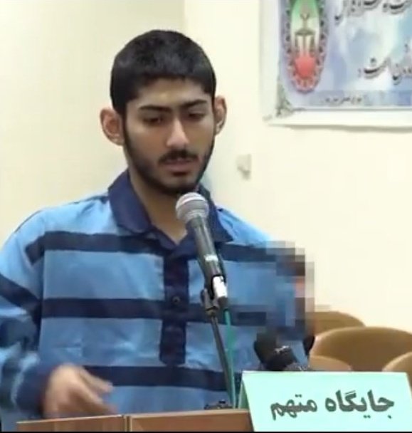 من با دیدن این تصاویر فقط یه چیز میاد توی ذهنم. یه محمد حسینی دیگه...
صدای #احسان_حسینی_پور باشیم. این جوون فقط ۱۹ سالشه و به شدت در خطره.