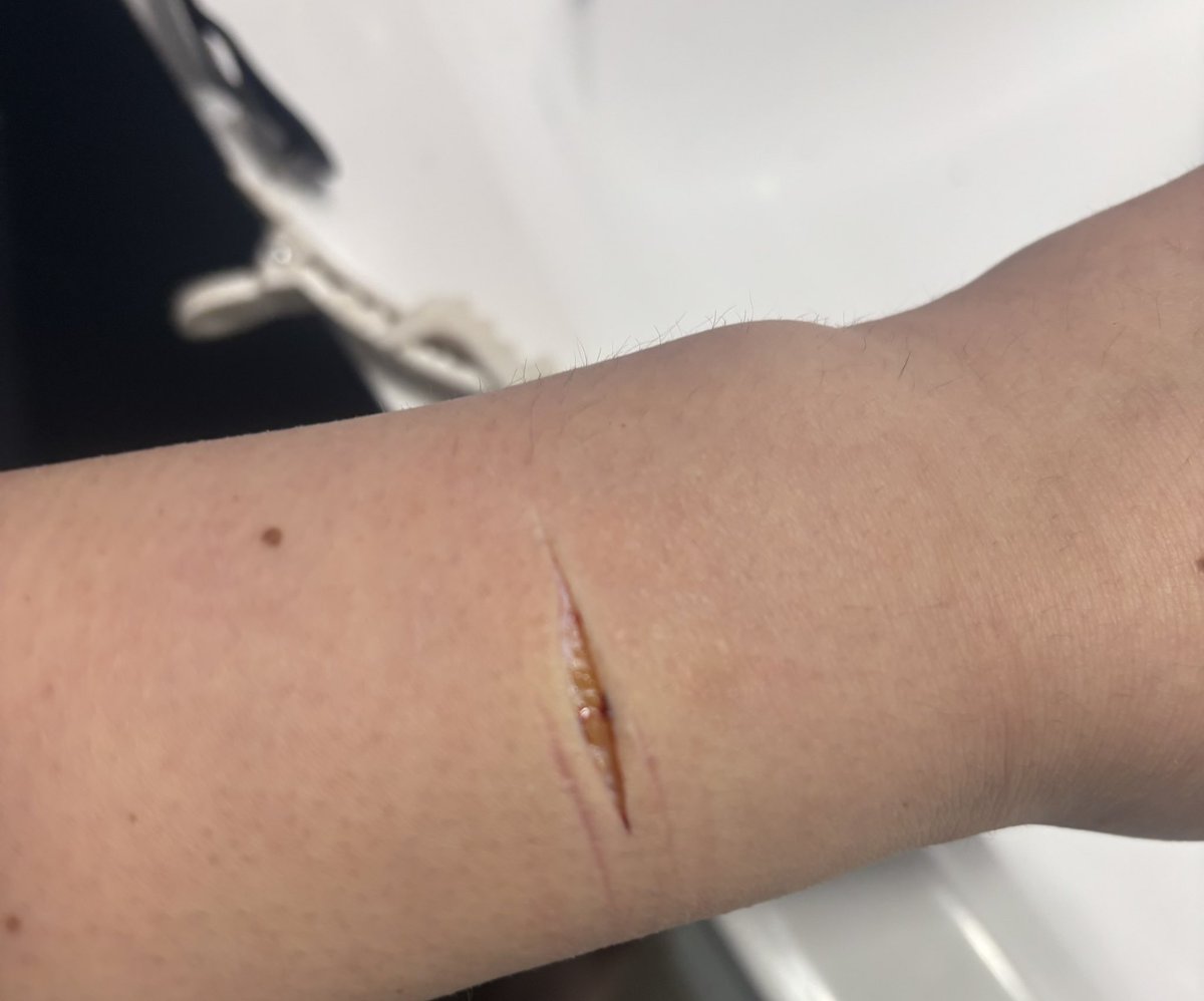 starv4them's tweet photo. sfx makeup https://t.co/oHn985zflv