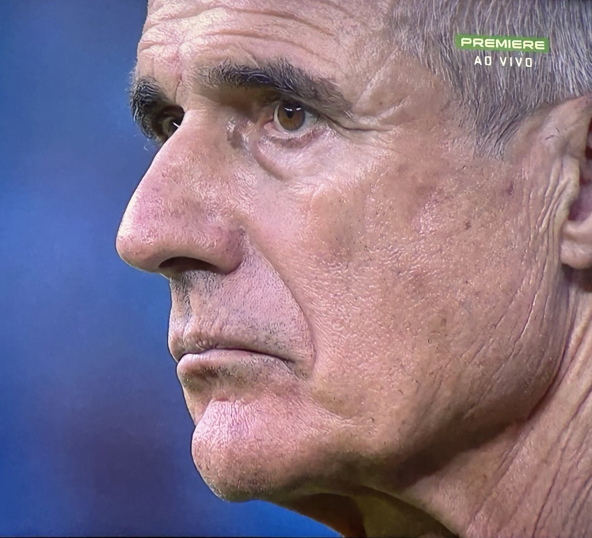 GREMISTÓN tweet media