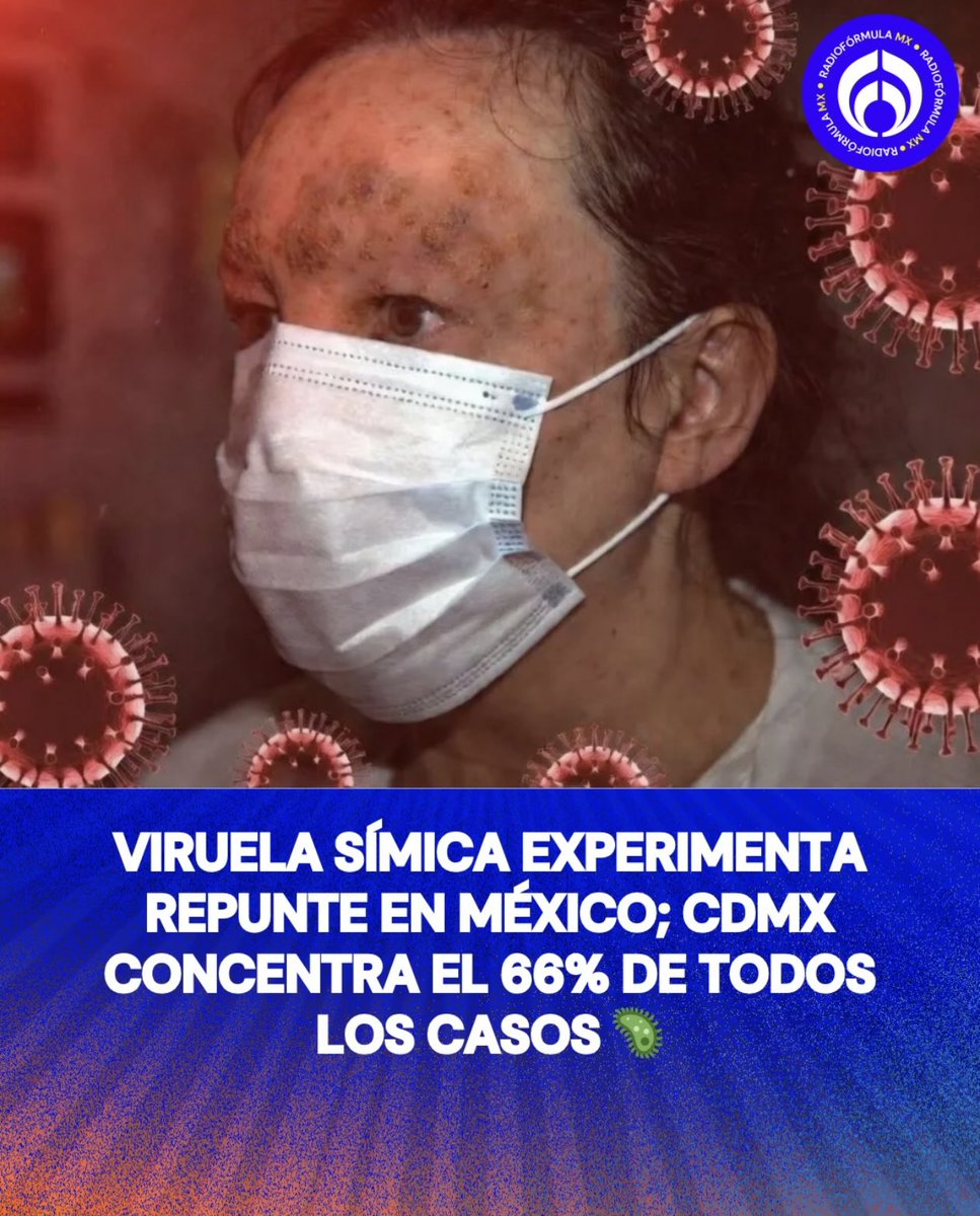 Digo. Por si algo faltaba. Aparecen casos de viruela, sí, viruela en México. Antes de esta pesadilla cuatrotera también estaba erradicada. El sistema de salud es un fracaso. Con info de <a href="/Radio_Formula/">Grupo Fórmula</a>. <a href="/Claudiashein/">Claudia Sheinbaum Pardo</a> <a href="/DKershenobich/">Dr. David Kershenobich S</a> <a href="/opsoms/">OPS/OMS</a> <a href="/POTUS/">President Donald J. Trump</a> <a href="/SecRubio/">Secretary Marco Rubio</a> <a href="/RobertKennedyJr/">Robert F. Kennedy Jr</a>