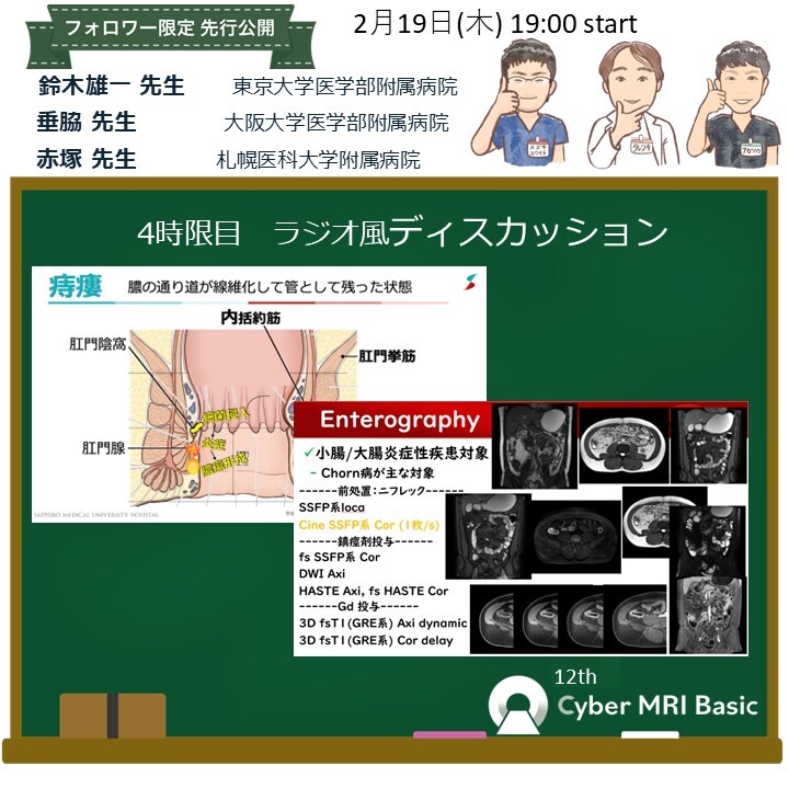 BasicMRI's tweet photo. 【第4弾】フォロワーのあなた��スライド
を見せしちゃいます🥳(拡散OK🙆‍♂️)
4時限目　ラジオ風ディスカッション　鈴木雄一先生、垂脇先生、赤塚先生
↓参加登録忘れずにー！
2026年2月19日(木)　19時～
https://t.co/WoldF6RMO7
#CyberMRI https://t.co/CzofgwiXcO