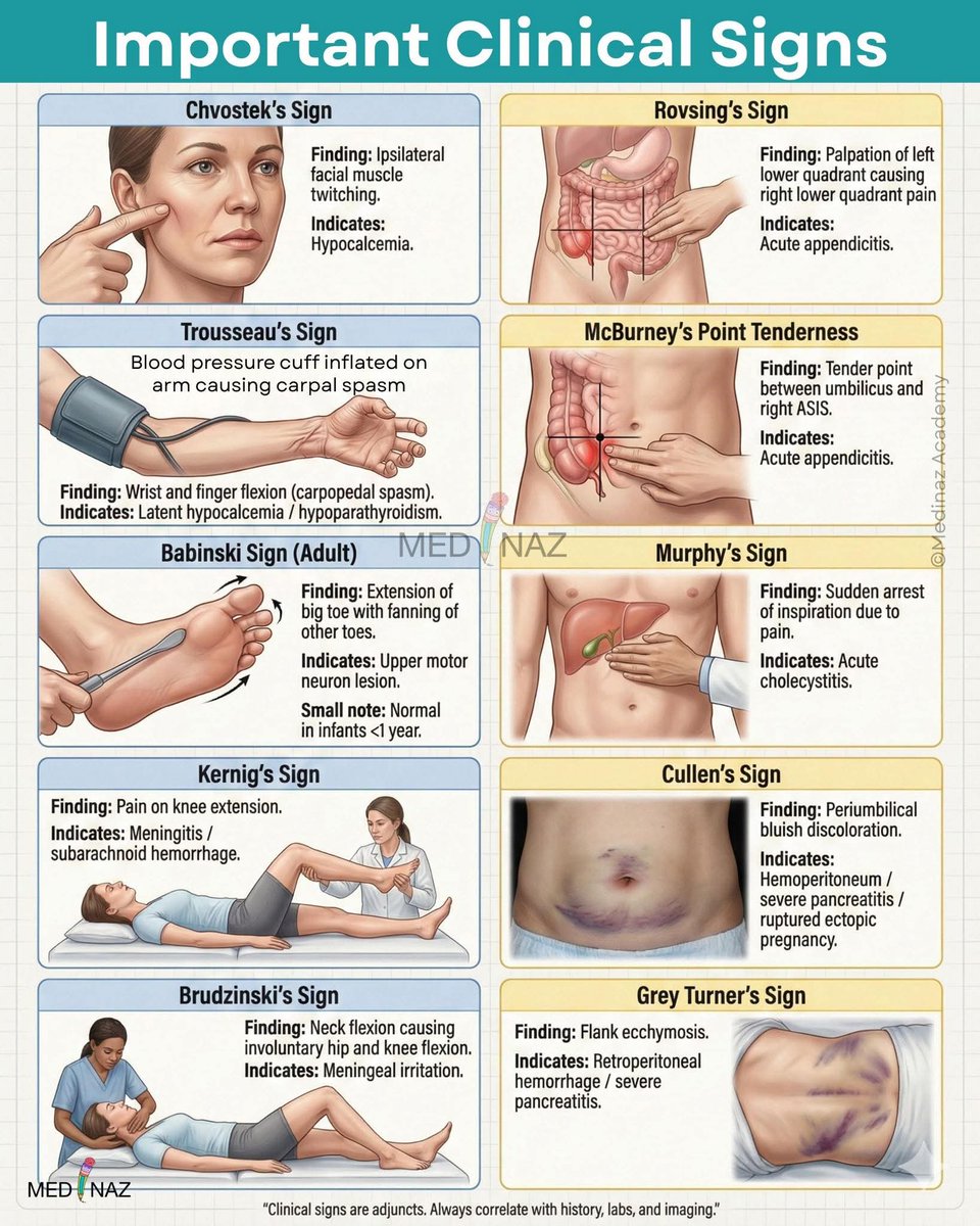 albertoortegana's tweet image. Important clinical signs ✅