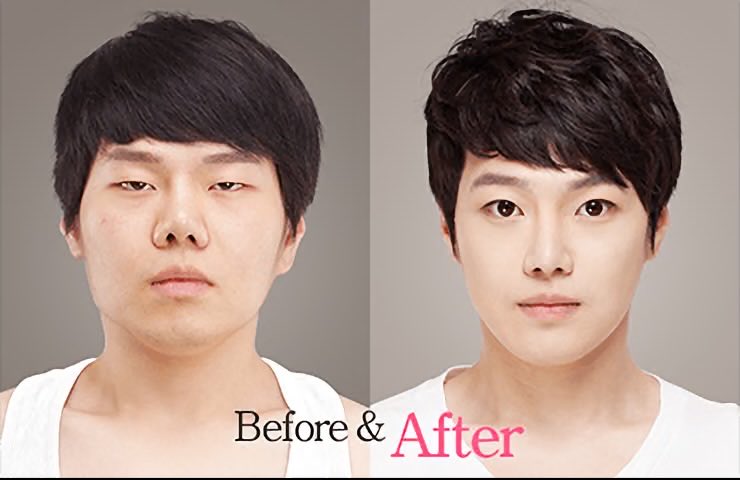 abcgtsgajj's tweet photo. @Daniellanisa the real face of a Korean person, his eyes are small like a hole in his butt https://t.co/1y0J9JFg4a