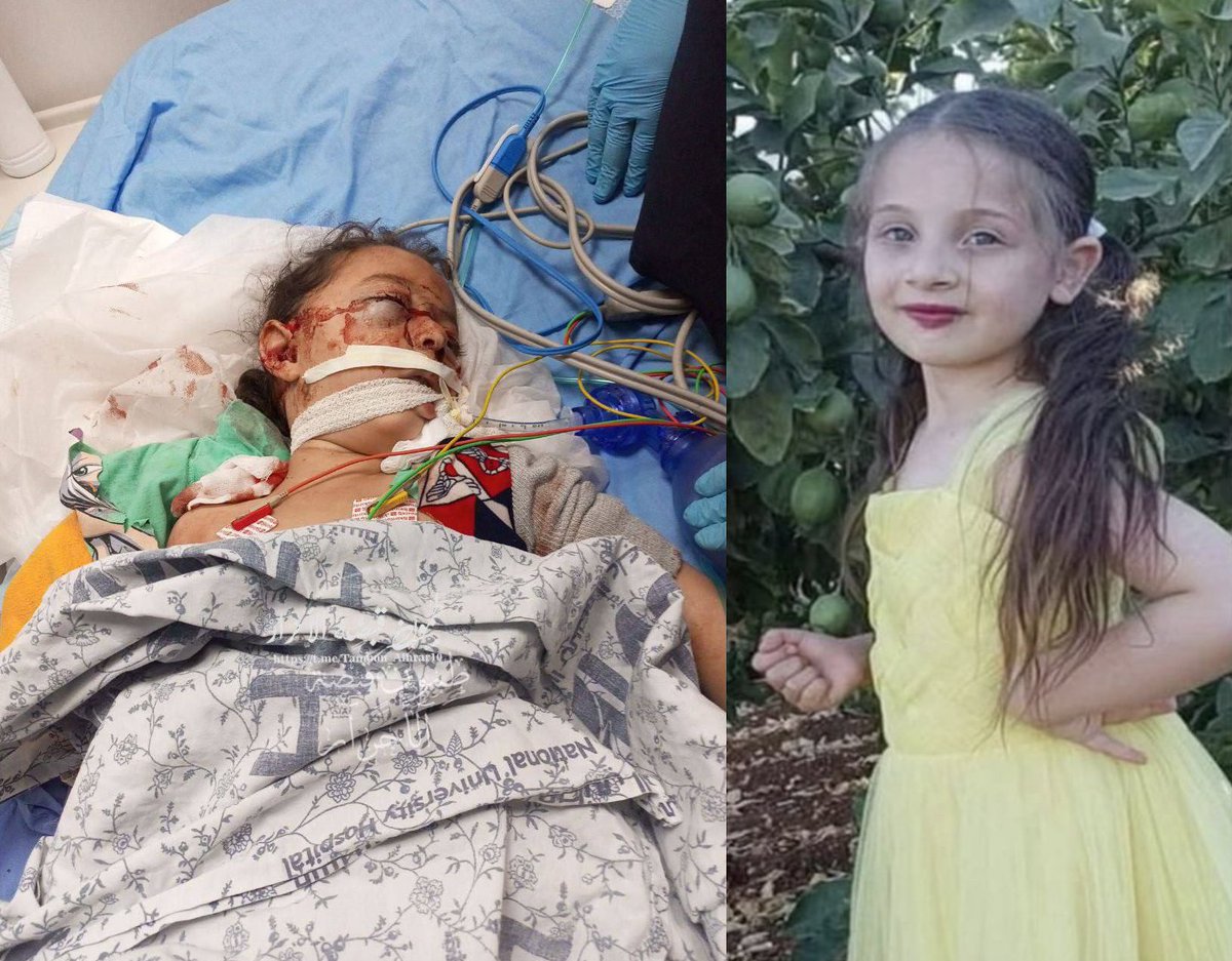 Hoy "Israel" ha asesinado a una niña palestina de 5 años y a su hermano adolescente de 16 años, después de abrir fuego contra un coche familiar durante su invasión militar a la aldea de Tubas, en Cisjordania.

No hay ni un solo dia en el que "Israel" no mate niños palestinos,