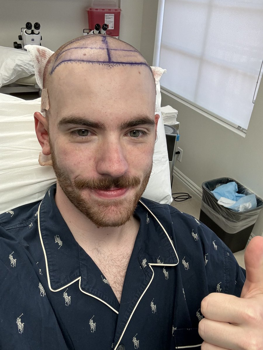 it’s kinda a shame sapnap grew his hair back. i bet he ran so much faster bald