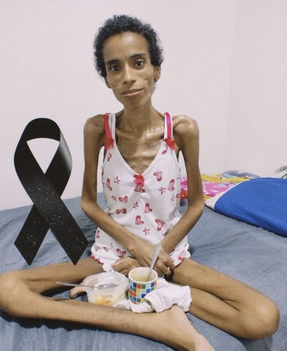 emmanuelmibimu's tweet photo. Un mari reste auprès de sa femme atteinte d’un cancer à un stade avancé, jusqu'à la fin de ses jours ! « Jusqu'à ce que la mort nous sépare ! » 🙏🏽📷📷 https://t.co/rOTUjPYasU
