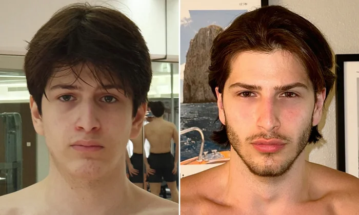 runitbackgoat's tweet photo. This is me before and after bone smashing https://t.co/YZ1T6VtxlW