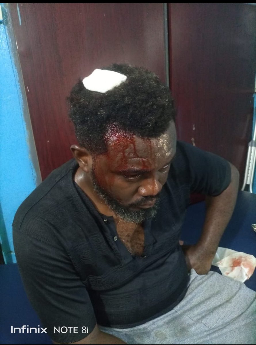 SavvyRinu's tweet photo. Day 2: How do Nigerians plan to prevent APC’s violence against voters in 2027? #NigeriaElects https://t.co/1RHztMENpv