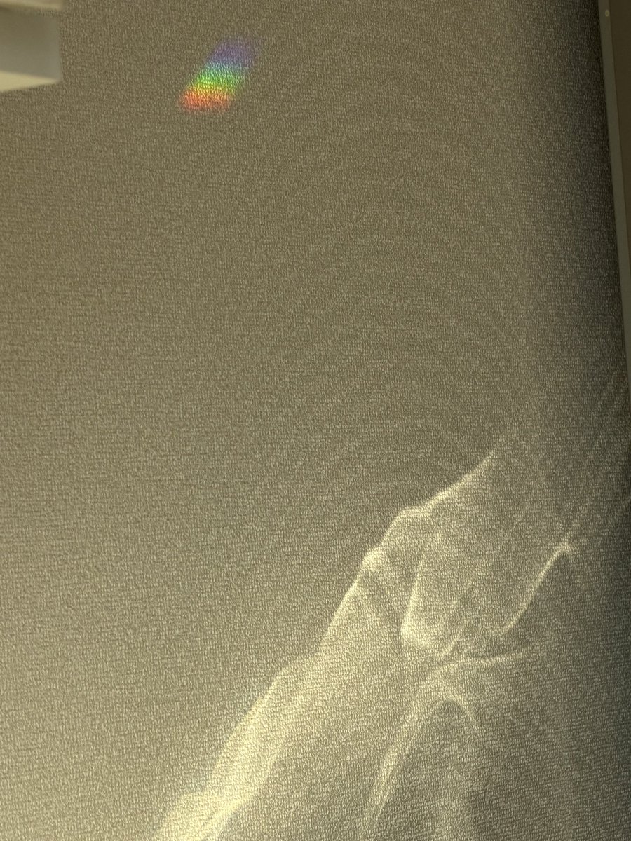 light_matsuko's tweet image. 午後活な私😌西の陽の当たりはｷﾂｲけどｻﾝｷｬｯﾁｬｰやｶﾞﾗｽ置物の反射が部屋中に広がるのがお気に入り✨水中に小さな熱帯魚が泳ぐような空間で暖かいｺｺｱと癒し時間を満喫💝

と、囁きｳﾞｫｲｽのVlog女子を
真似たで🍌
#意識高い系
#vlogger