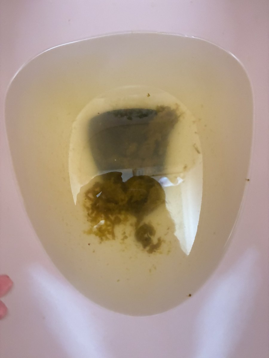 rz_fxb's tweet photo. 1つ目の動画は出先で撮ったので店内BGMうるさいです ( ˃ ˂ )
おなら出ててはずかしい 、ずーっとゆるめ ՞߹ - ߹՞
お腹いたいのにちょっとずつしか出なくて何回もトイレ行ってる https://t.co/TxBU3hEflw