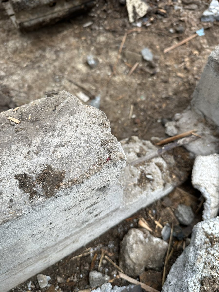 すっ転んでコンクリートの角に頭突きした…
コンクリートには勝てなかったわー🙃

頭ぶつけて
血塗れになった☺