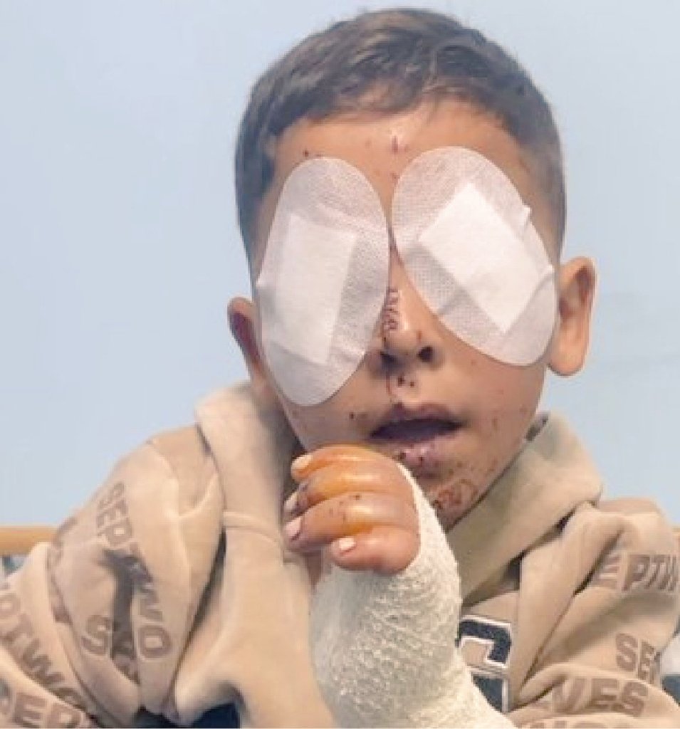 Yousef in Gaza 🇵🇸 tweet media