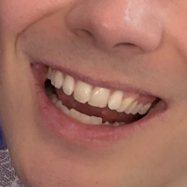 dontcrycum's tweet photo. i lovelovelove dan's teeth #teethplay https://t.co/2NIzVF2GP6