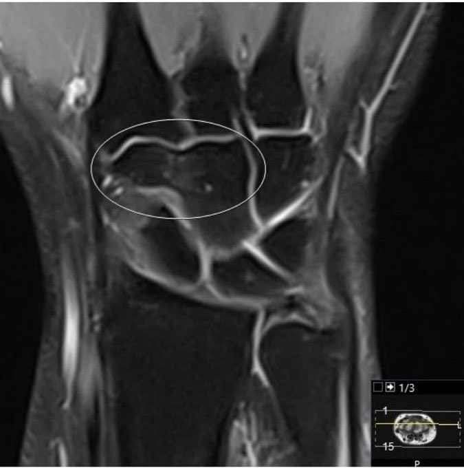 عبدالاله ابن عســاف☢ tweet media