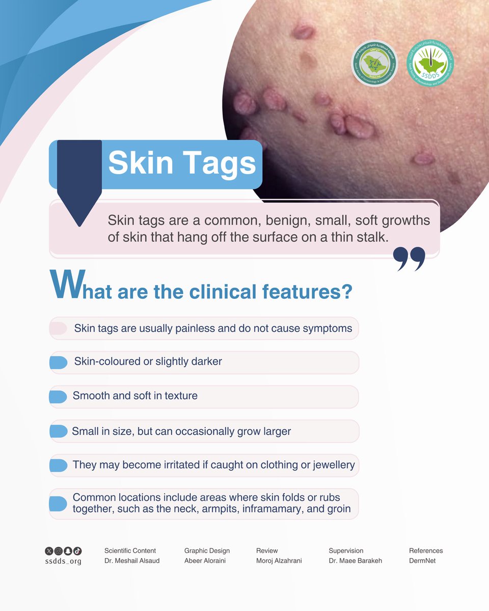 نادي الأمراض الجلدية tweet media