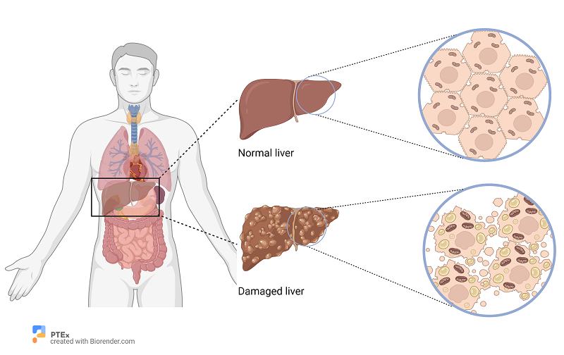 PathologyTestsExplained tweet media