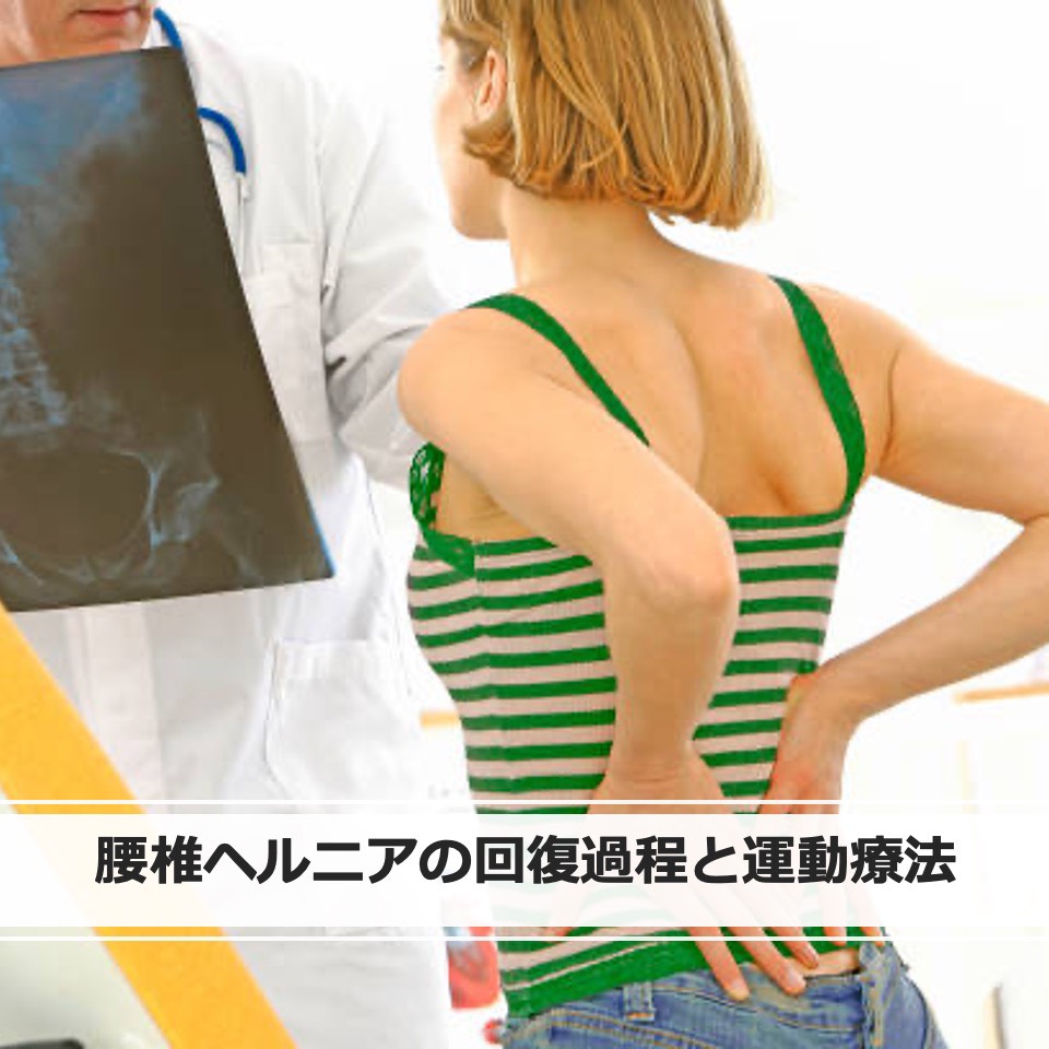 fhu_rehabil's tweet photo. 藤田医科大学リハビリテーション学科です｡

今回は【腰椎ヘルニアの回復過程と運動療法】を特徴と対処法の２回に分けて紹介します！

ヘルニアは日本人を悩ます疾患です｡まずはこの病気の特徴をお伝えします♪

#藤田医科大学
#リハビリテーション学科
#理学療法
#作業療法
#椎間板ヘルニア https://t.co/RPToUWJURf