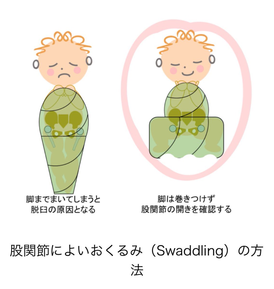 Ortho_FL's tweet photo. また間違った育児ライフハック動画が流れてきましたが、赤ちゃんは脚までしっかり縦巻きにするおくるみは股関節の発育上良くないとされてるので知っておいてくれ！

上半身は丸めて下半身はフリーにする巻き方を日本小児整形外科学会も推奨してるよ！！

子どもの股関節の未来のために頼む！！ https://t.co/FXBLO19IZ6