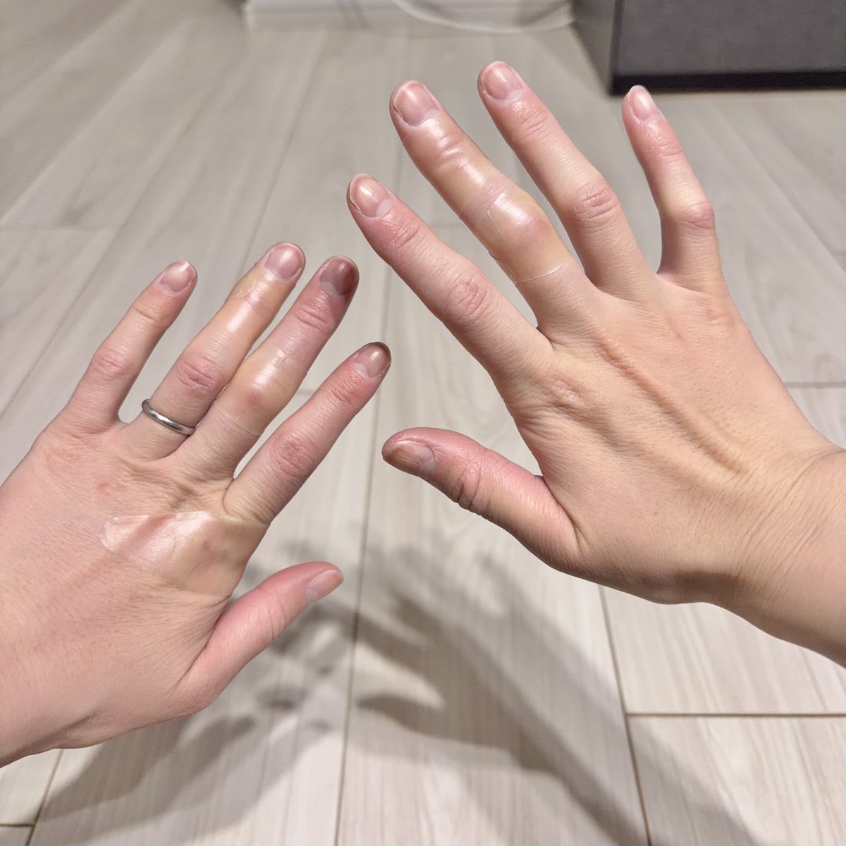 これすぎる
妊娠前と産後の私の手を見て😂😂