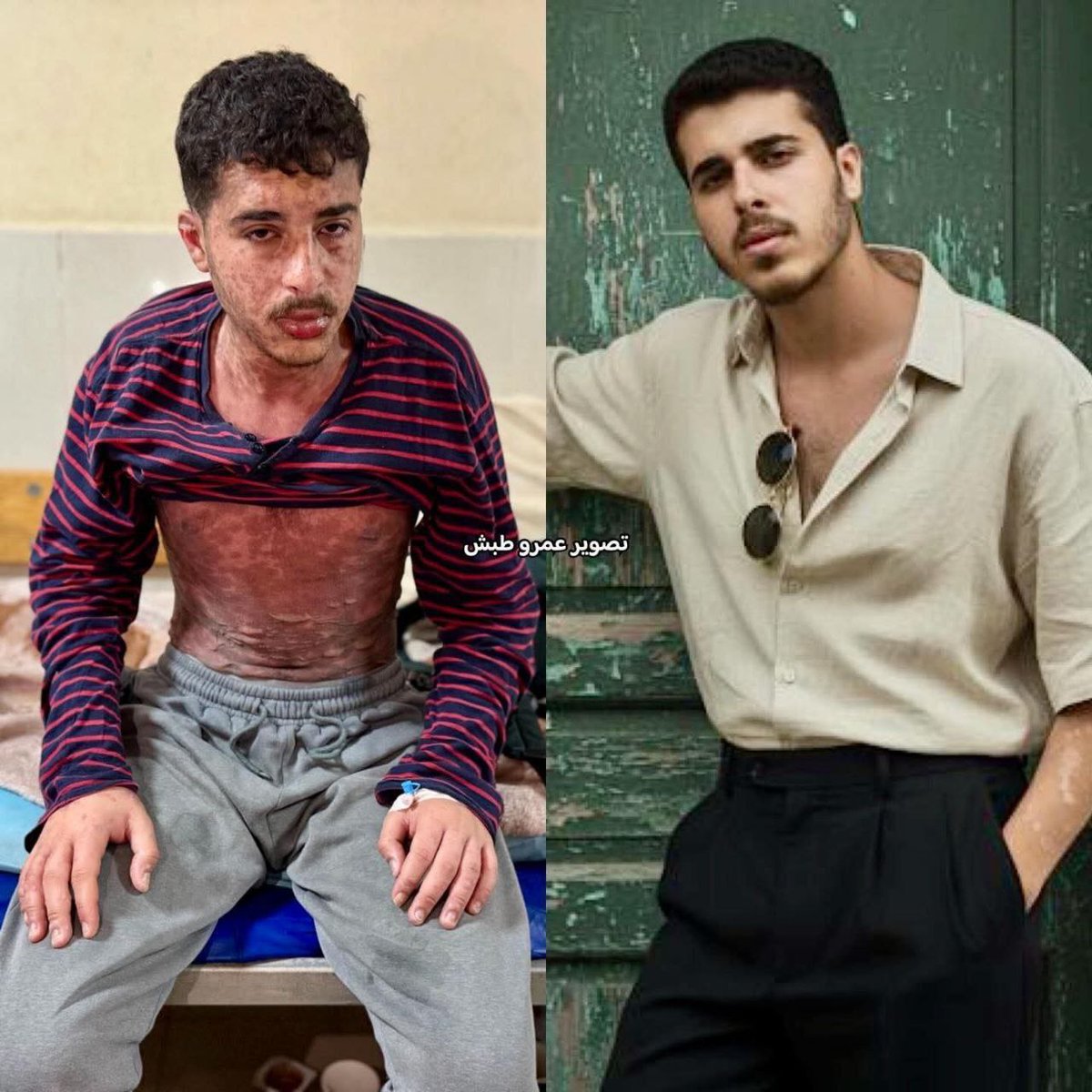 Haitham in Gaza 🇵🇸🍉 tweet media
