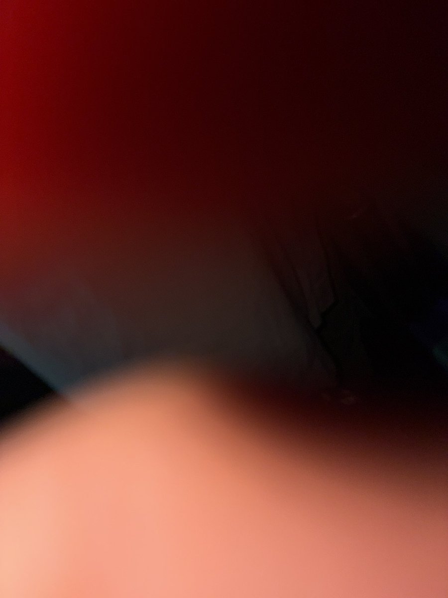 What part of my body is this??