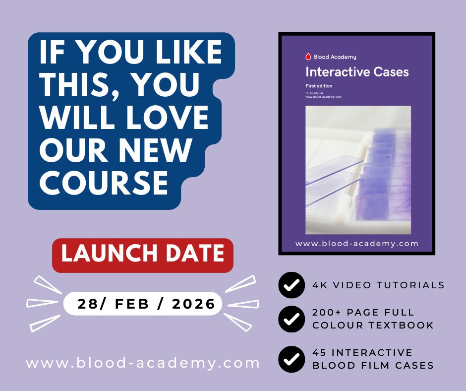 🩸 Test yourself

32-year-old male with fatigue
Hb 41 g/L | WCC 8.5 ×10⁹/L | Platelets 190 ×10⁹/L
What is the diagnosis?

🔬View the digital blood film: bit.ly/4reWuC9

📘 Interactive Cases launches 28 Feb 2026