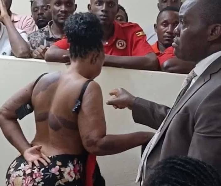 AAgather's tweet photo. In March 2025, Kawempe Magistrate William Muwonge remanded NUP supporters that had been severely assaulted by security agencies during a campaign rally for the Kawempe North by-election. One of them had been rumored dead before she was detained at Wandegeya police station because she was beaten into unconsciousness, the others could barely sit and one collapsed in court twice. He disregarded the law he’s mandated to uphold. #UgandaJudiciaryExhibition