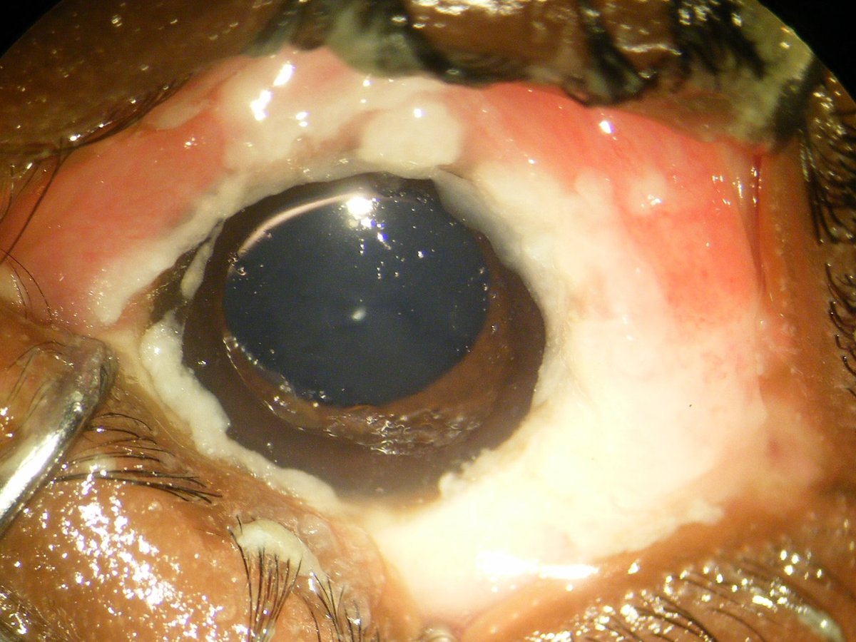 Pathogen Genomic Lab - INRB tweet media