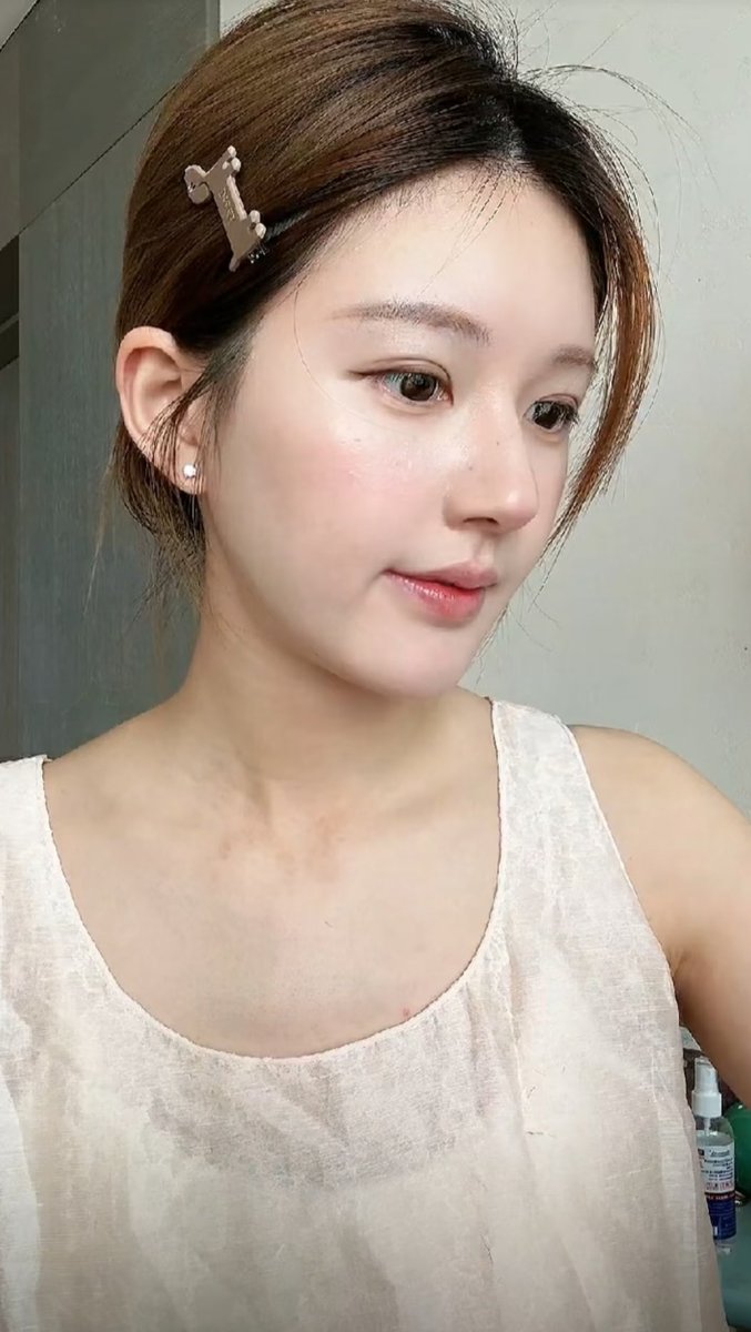 Zhao Lusi just shared that her allergies will leave scars every time , and she’s dealing with them right now. 

Hope she takes good care of herself and heals well.