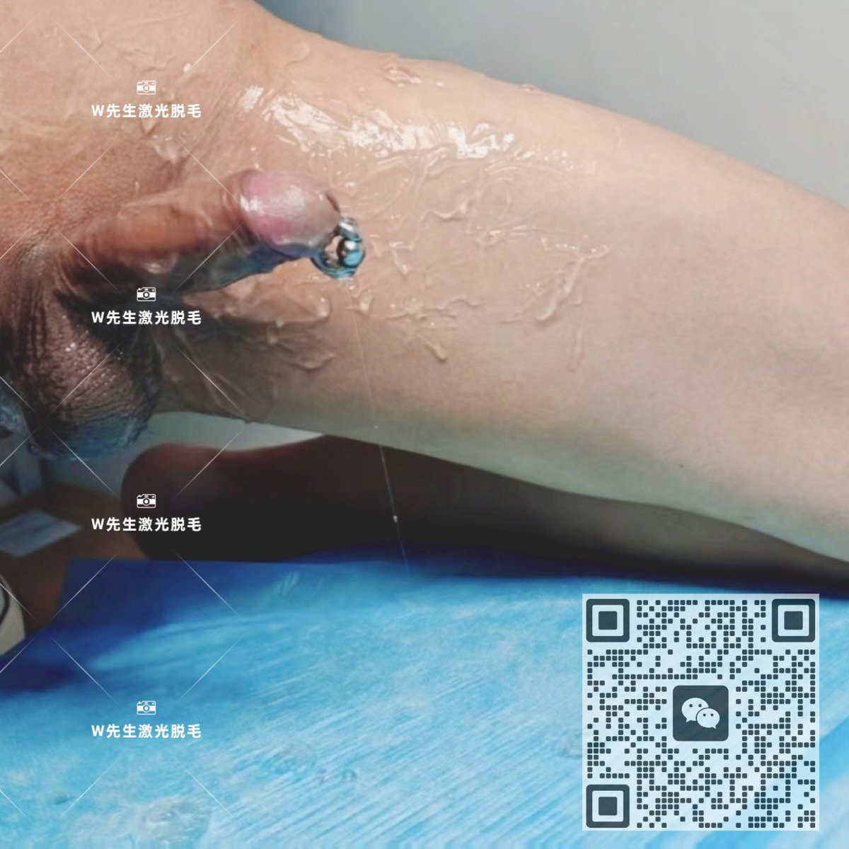W先生上海男士脱毛 tweet media
