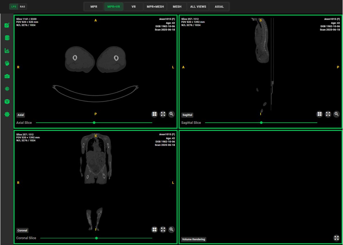 The kind of DICOM viewer we build for our clients. Fully customizable and runs on the web.