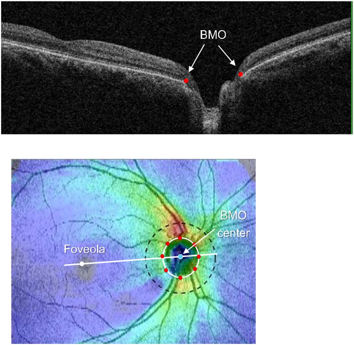 Ophthalmology tweet media