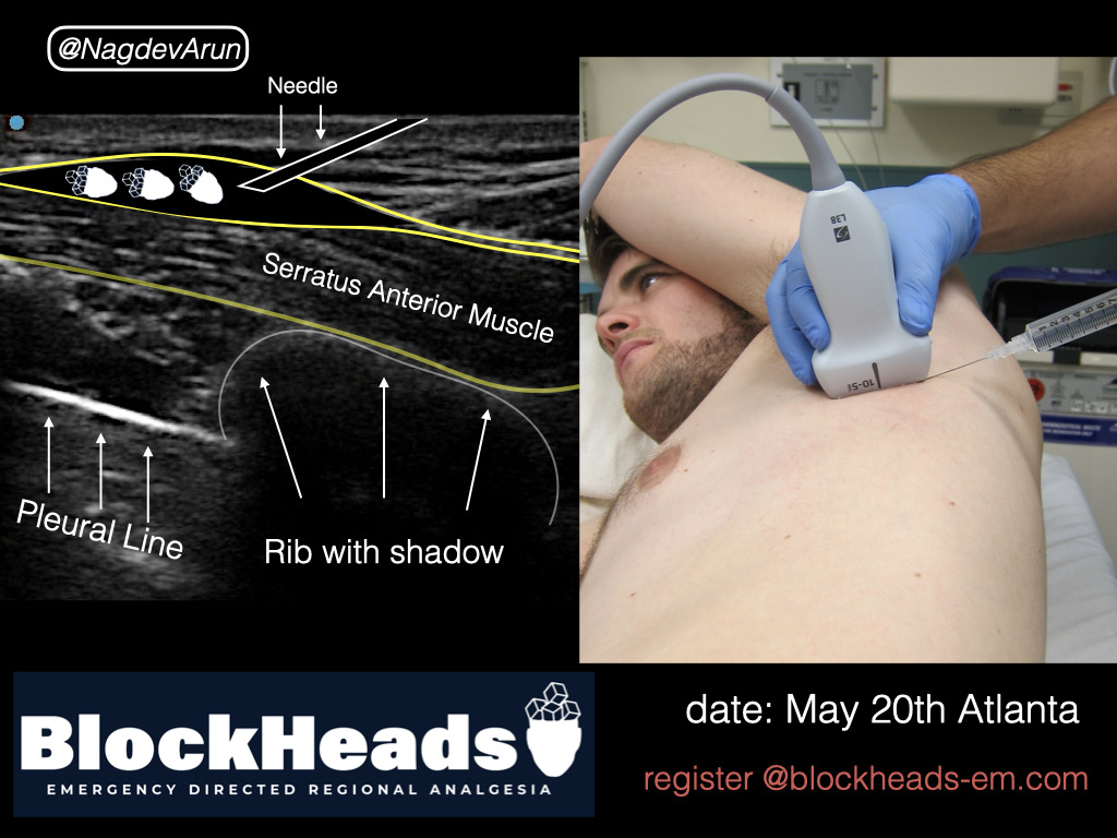 BlockHeads tweet media