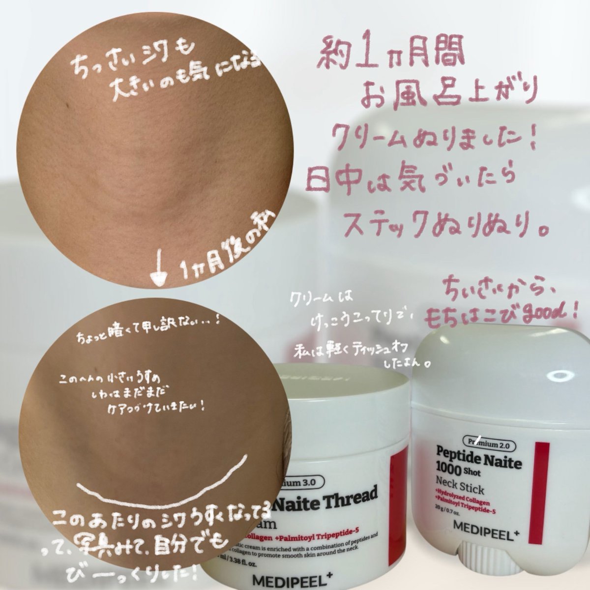 nana_10kgka's tweet image. 🏷️#PR

#MEDIPEEL
#NeckCream
#NeckStick

＼首まで可愛くなりませんか〜！！／

首のシワの原因って知ってますか？🤔
・年齢を重ねることでハリを支える成分が減少
・乾燥
・紫外線ダメージ
・スマホやPCによる前傾姿勢
　→いわゆるストレートネック
