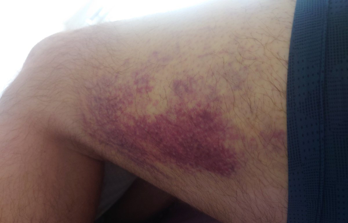 Kickboxing is all fun and games until you get kickboxed.