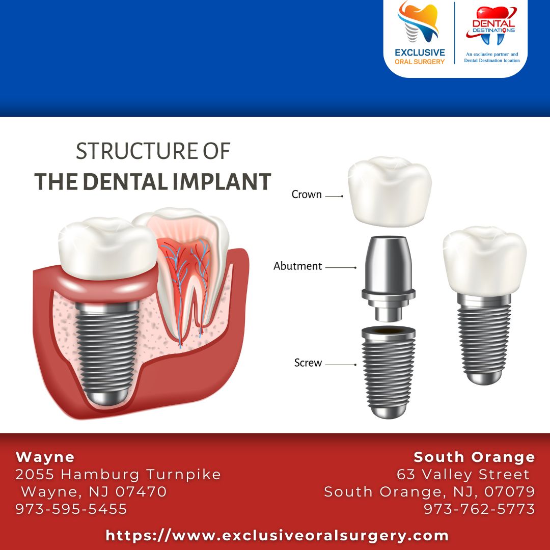 ExclusiveOral's tweet photo. Exclusive Oral Surgery - We're Your Partner in Radiant Oral Health!

South Orange:
63 Valley St, South Orange, NJ 07079
973-762-5773

Wayne:
2055 Hamburg Turnpike, Wayne, NJ 07470
973-595-5455

https://t.co/B8vJdtsMkh

#wayneoralsurgeon #southorangeoralsurgeon #dentalimplants https://t.co/J4V9Uw00cs