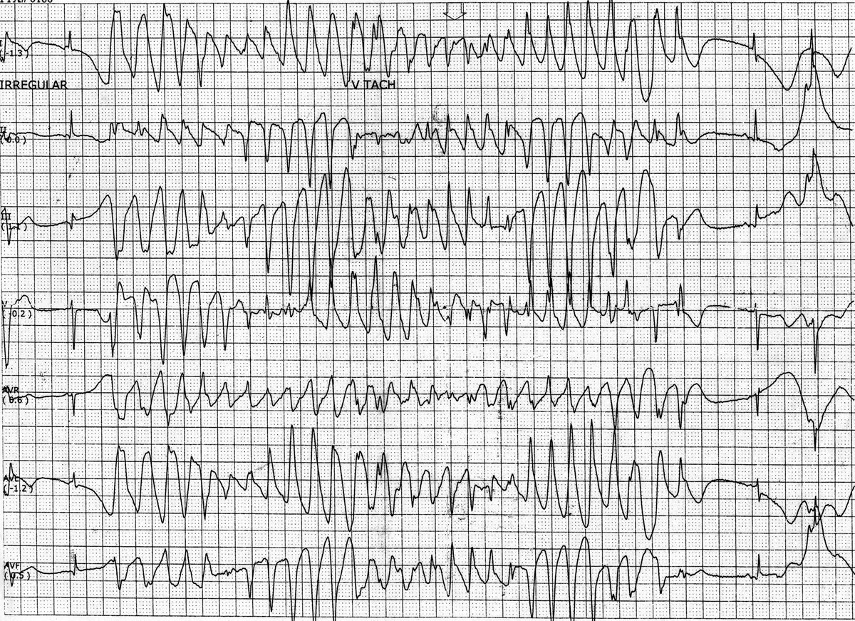 Philip J Podrid MD tweet media