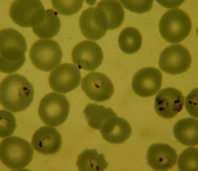 UK NEQAS Microbiology tweet media