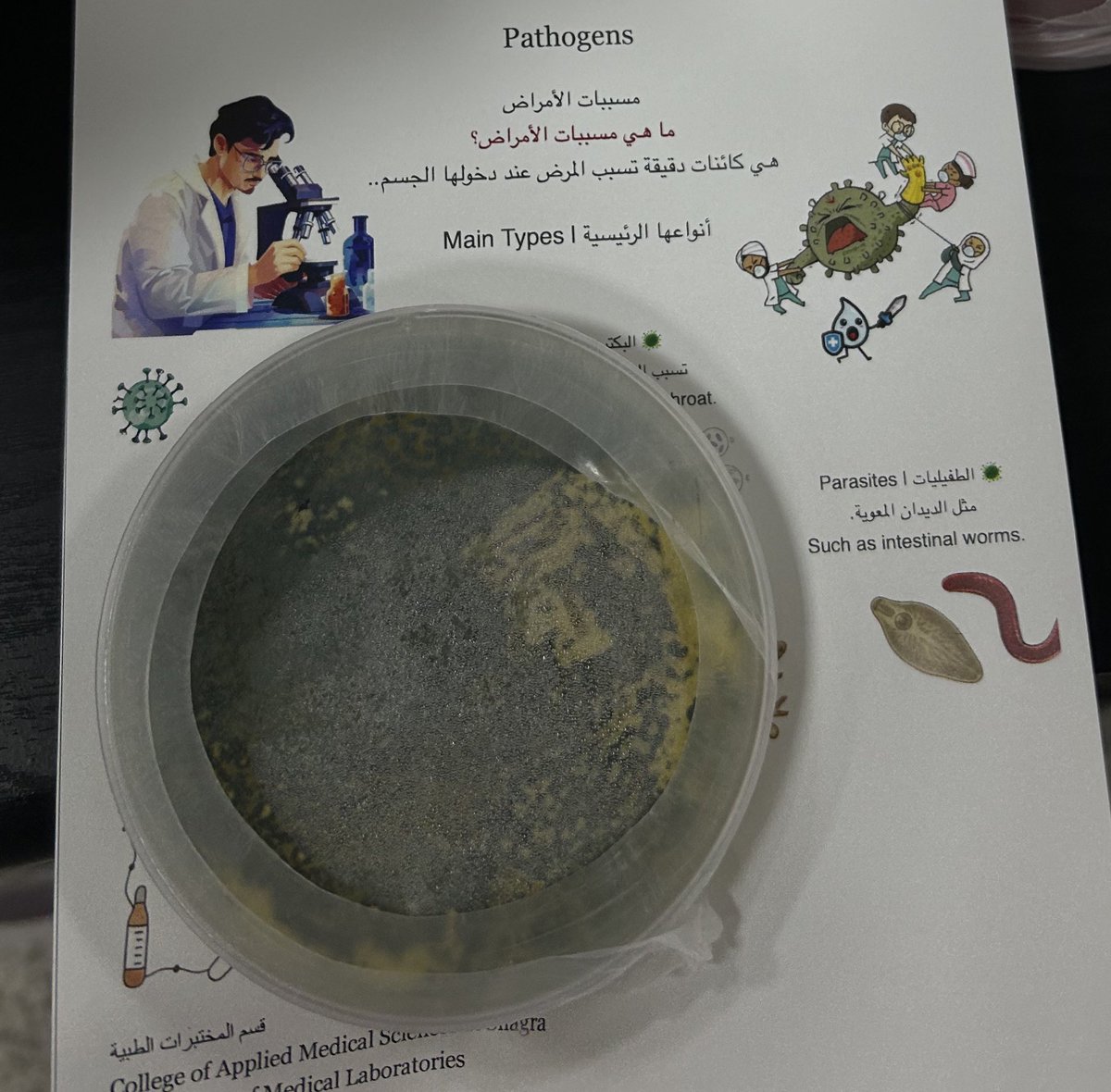 gdbr354529's tweet photo. الفطريات هي كائنات دقيقة ، وتوجد في الهواء والتربة…
بعض الفطريات ليس ضاراً ، و بعضُها يسبب أمراضًا، مثال : Athlete’s foot  و Candidiasis .
تنتقل عن طريق الملامسة أو استخدام الأدوات الشخصية المشتركة. 
وتعيش في الاماكن  الدافئة و الرطبه. https://t.co/byP99AO0Qx