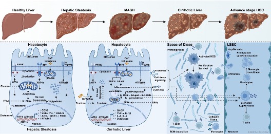 HEPATOLOGY Journal tweet media