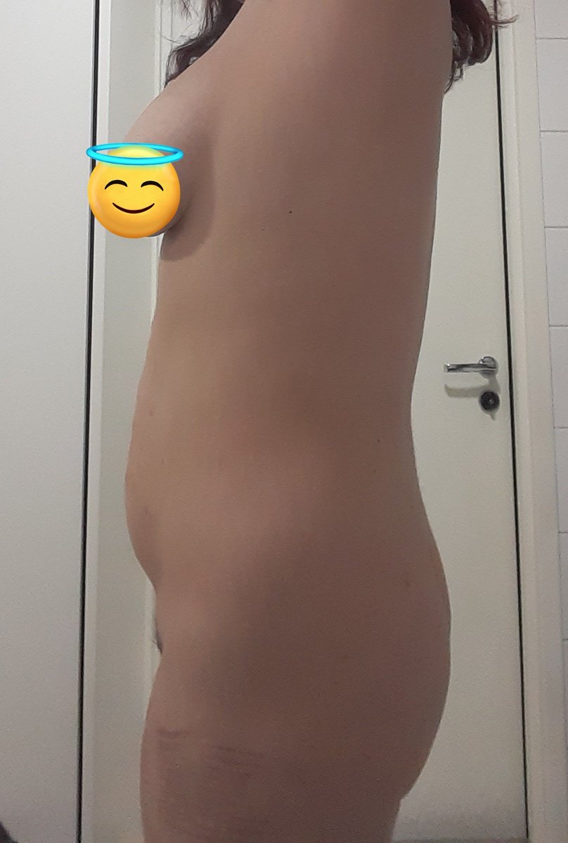 1 year ago vs now. I often dont realise how much smaller my tits have gotten but omg theyre tiny nowadays compared to THAT