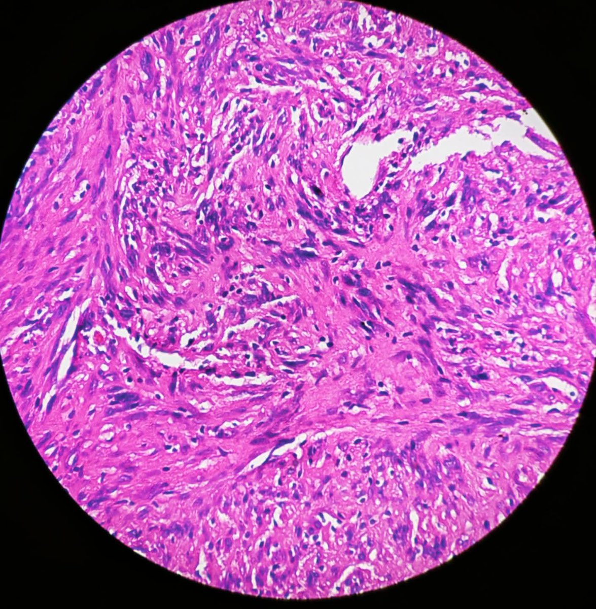 aung phyo tweet media