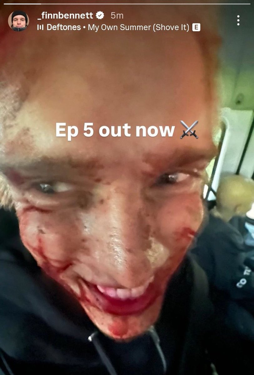 finn wants everyone to tune into episode 5